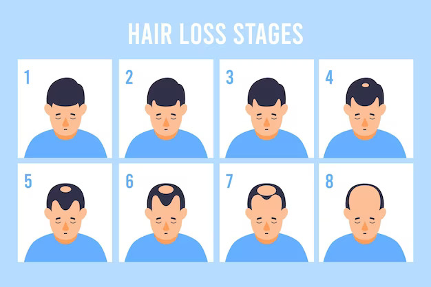 Hair growth stages
